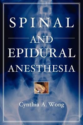 Spinal and Epidural Anesthesia