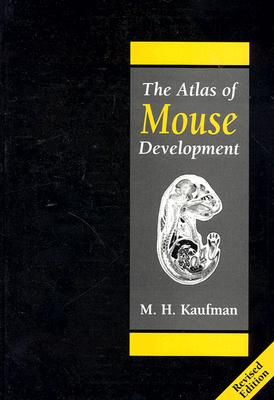 The Atlas of Mouse Development