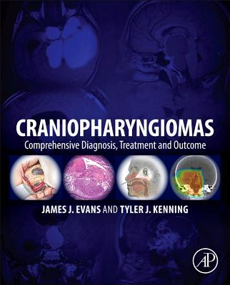 Craniopharyngiomas