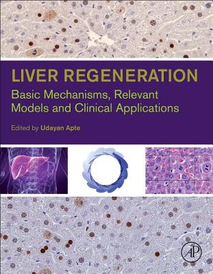 Liver Regeneration