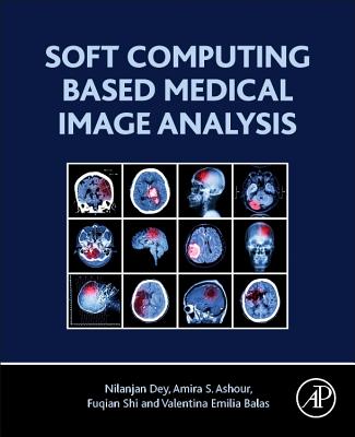 Soft Computing Based Medical Image Analysis