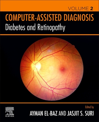 Diabetes and Retinopathy