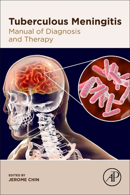 Tuberculous Meningitis