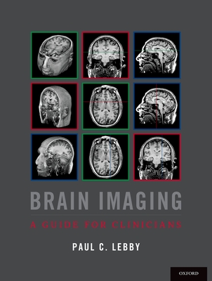 Brain Imaging