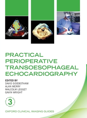 Practical Perioperative Transoesophageal Echocardiography