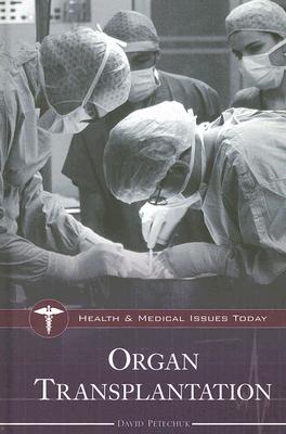 Organ Transplantation