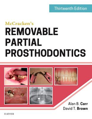 McCracken''s Removable Partial Prosthodontics