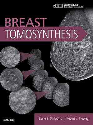 Breast Tomosynthesis