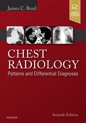 Chest Radiology