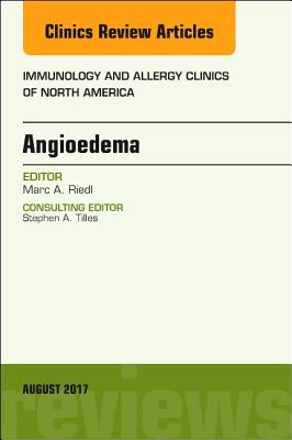 Angioedema, An Issue of Immunology and Allergy Clinics of North America