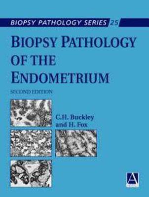 Biopsy Pathology of the Endometrium, 2Ed