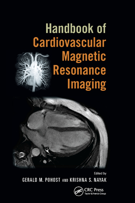 Handbook of Cardiovascular Magnetic Resonance Imaging