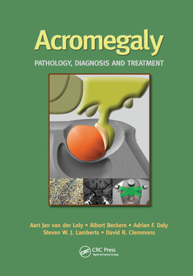 Acromegaly