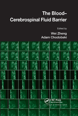 The Blood-Cerebrospinal Fluid Barrier