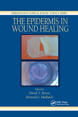 The Epidermis in Wound Healing