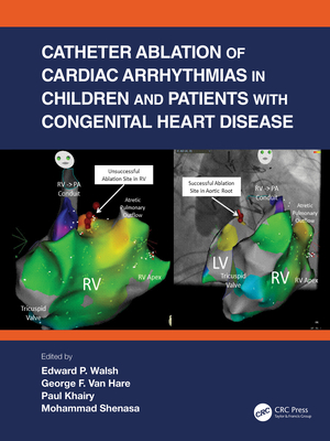 Catheter Ablation of Cardiac Arrhythmias in Children and Patients with Congenital Heart Disease