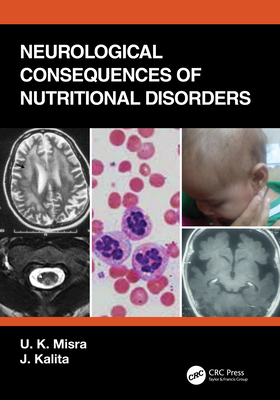 Neurological Consequences of Nutritional Disorders