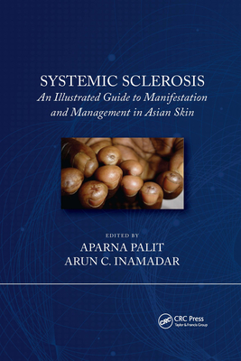 Systemic Sclerosis