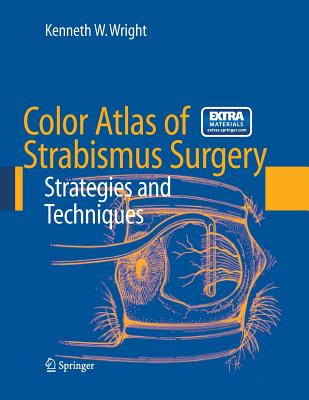 Color Atlas of Strabismus Surgery