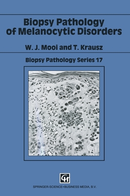 Biopsy Pathology of Melanocytic Disorders