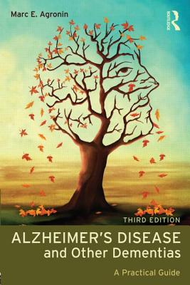 Alzheimer's Disease and Other Dementias