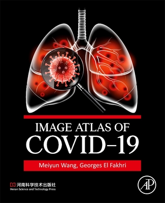 Image Atlas of COVID-19