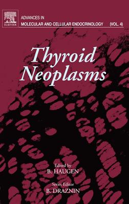 Thyroid Neoplasms