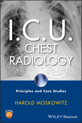 I.C.U. Chest Radiology