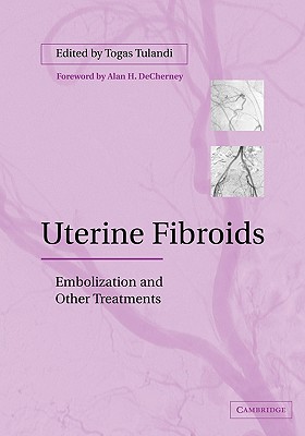 Uterine Fibroids