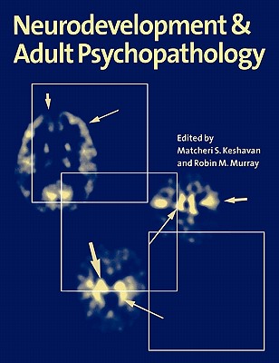 Neurodevelopment and Adult Psychopathology