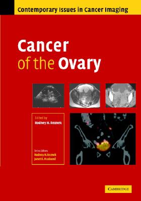 Cancer of the Ovary