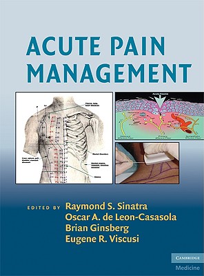 Acute Pain Management