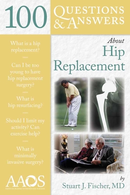 100 Questions  &  Answers About Hip Replacement