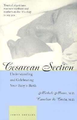 Cesarean Section