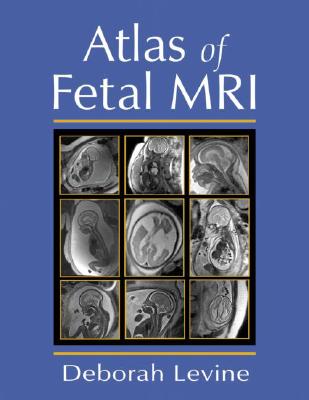 Atlas of Fetal MRI