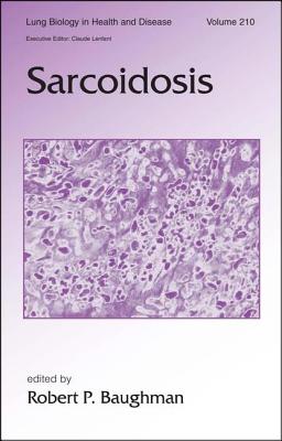 Sarcoidosis