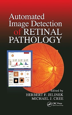 Automated Image Detection of Retinal Pathology