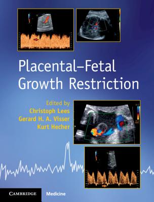 Placental-Fetal Growth Restriction