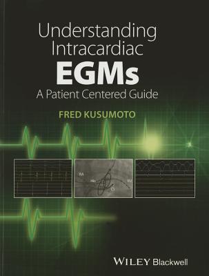 Understanding Intracardiac EGMs