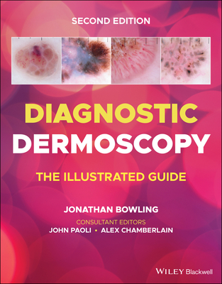 Diagnostic Dermoscopy