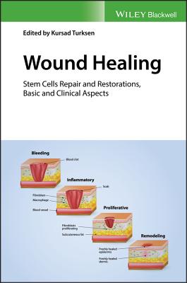 Wound Healing