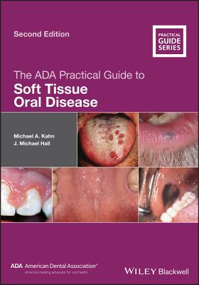 The ADA Practical Guide to Soft Tissue Oral Disease