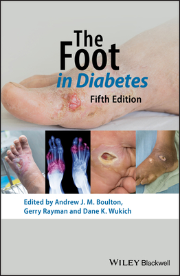 The Foot in Diabetes