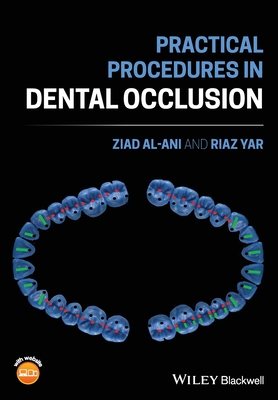 Practical Procedures in Dental Occlusion