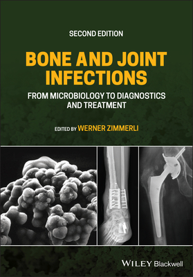 Bone and Joint Infections