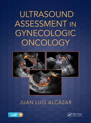 Ultrasound Assessment in Gynecologic Oncology