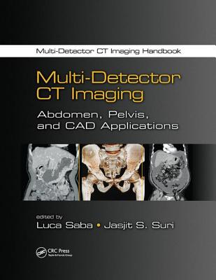 Multi-Detector CT Imaging