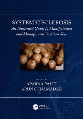 Systemic Sclerosis