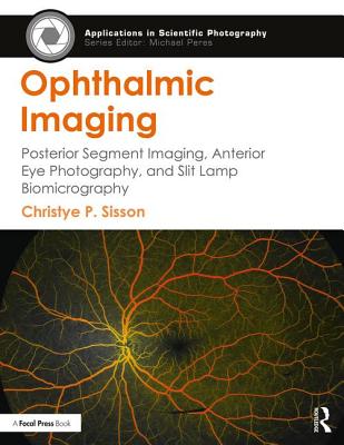 Ophthalmic Imaging