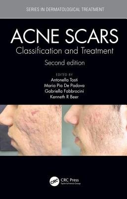 Acne Scars